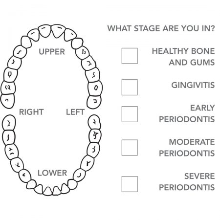 Gum Disease - Impressions Dental Centres